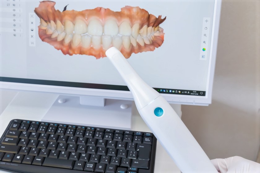 02先進機器による精密治療